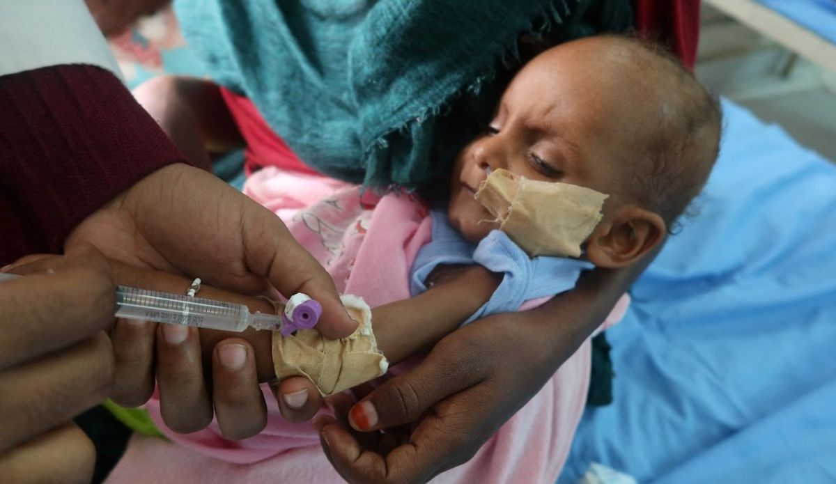 ​A child, suffering from malnutrition, is treated at Port Sudan Paediatric Centre, during a visit by WHO Director-General Tedros Adhanom Ghebreyesus to the country, in Sudan, on Sept. 7, 2024. 