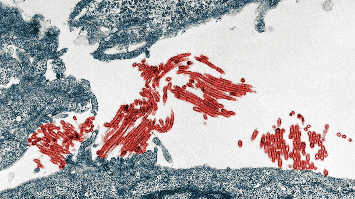 ​The H1N1 flu virus (red) is pictured in this handout photograph taken on July 9, 2009 and released on July 13, 2009. The new H1N1 influenza virus bears a disturbing resemblance to the virus strain that caused the 1918 flu pandemic, with a greater ability to infect the lungs than common seasonal flu viruses, researchers reported Monday. 